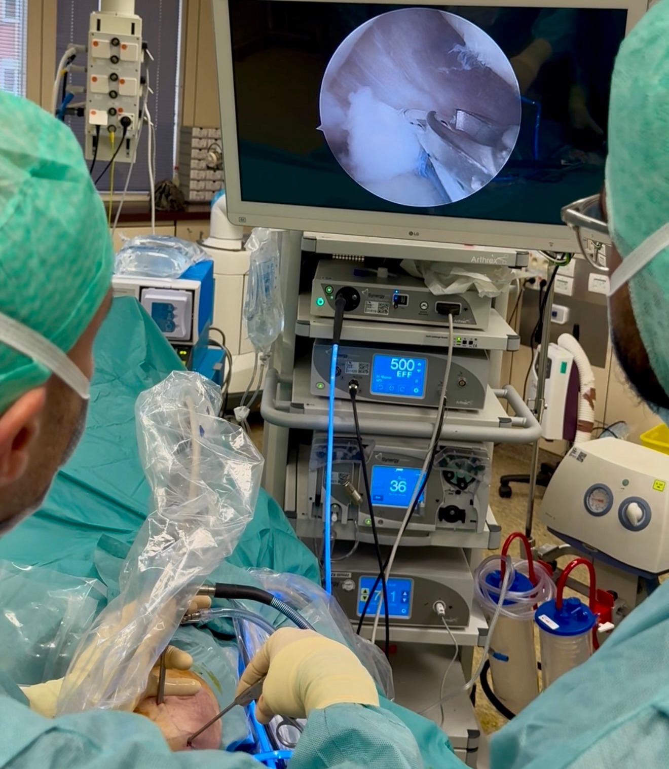 Arthroscopie du genou mini-invasive Bruxelles